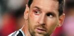 Qué le pasó a Messi en el ojo: el 10 recibió atención en medio de Argentina vs Suiza e2JhJ16Gd_1256x620__1